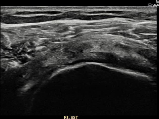 ケース 10 施術後