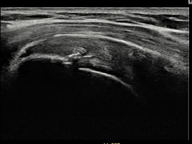 ケース 11 施術後