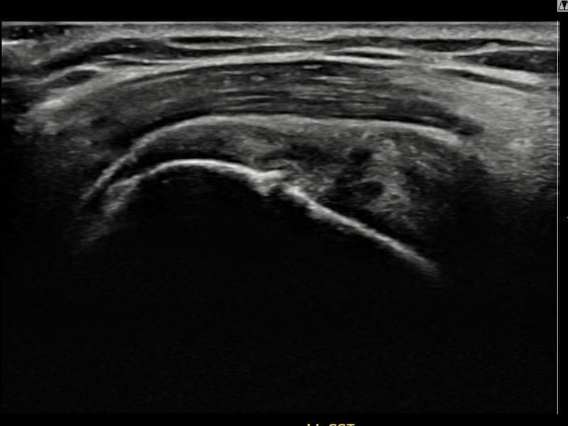 病例No.11 — 术前