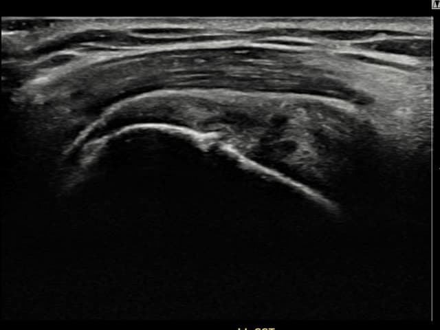 ケース 11 施術前