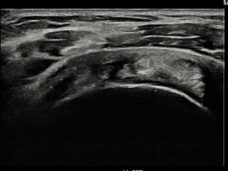病例No.12 — 术前