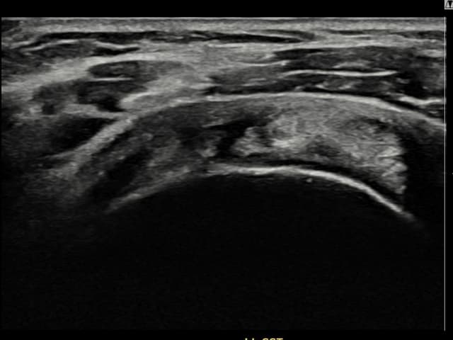 ケース 12 施術前