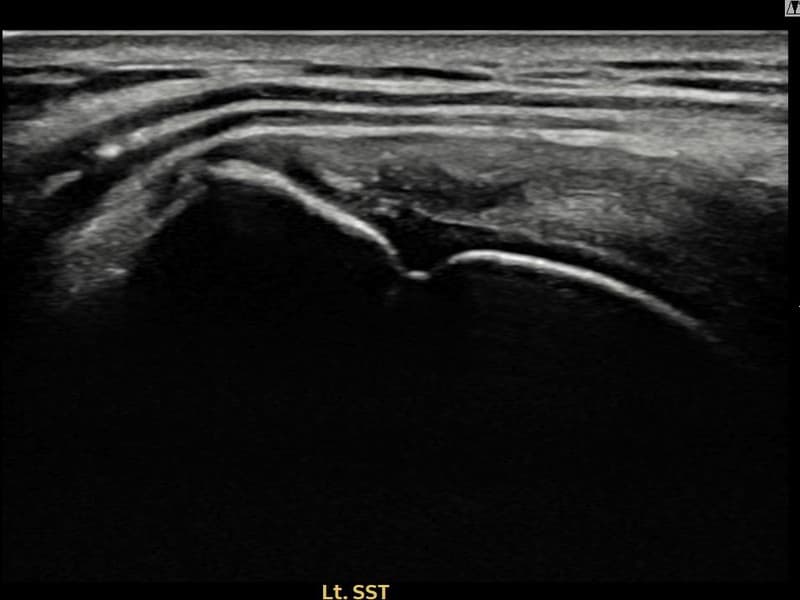 病例No.15 — 术前
