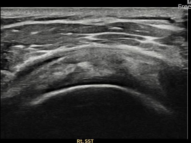 ケース 17 施術後