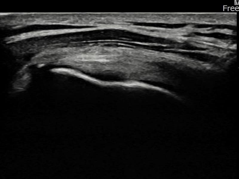 病例No.18 — 术后