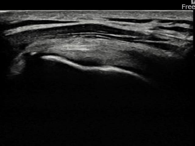ケース 18 施術後