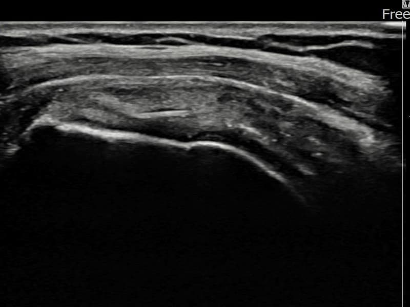 病例No.19 — 术后