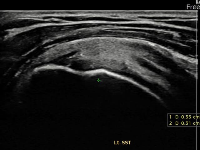 ケース 19 施術前