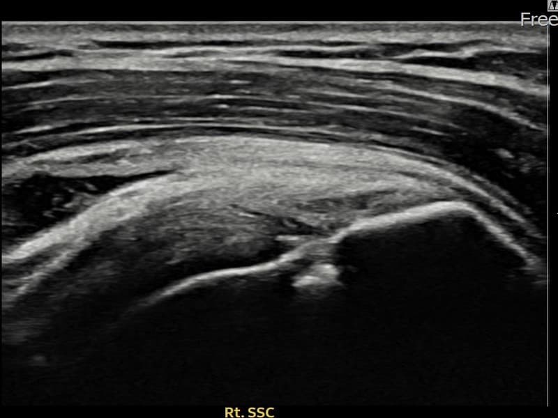 病例No.22 — 术后