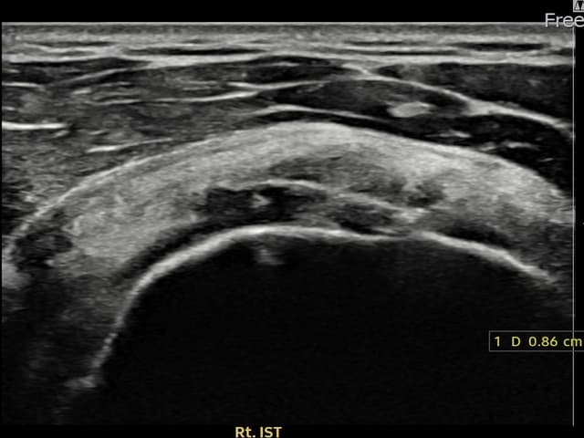ケース 22 施術前