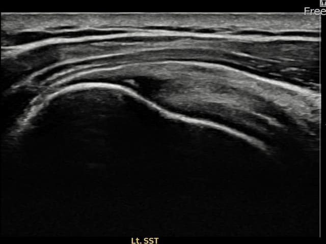 정ㅇㅇ님 시술 전