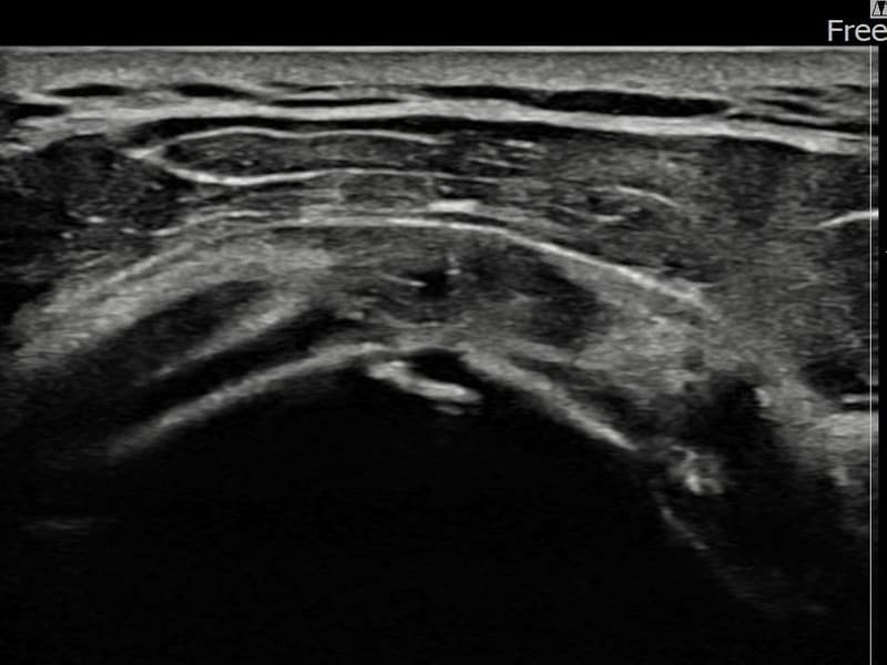 病例No.24 — 术后