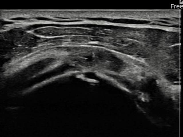 ケース 24 施術後