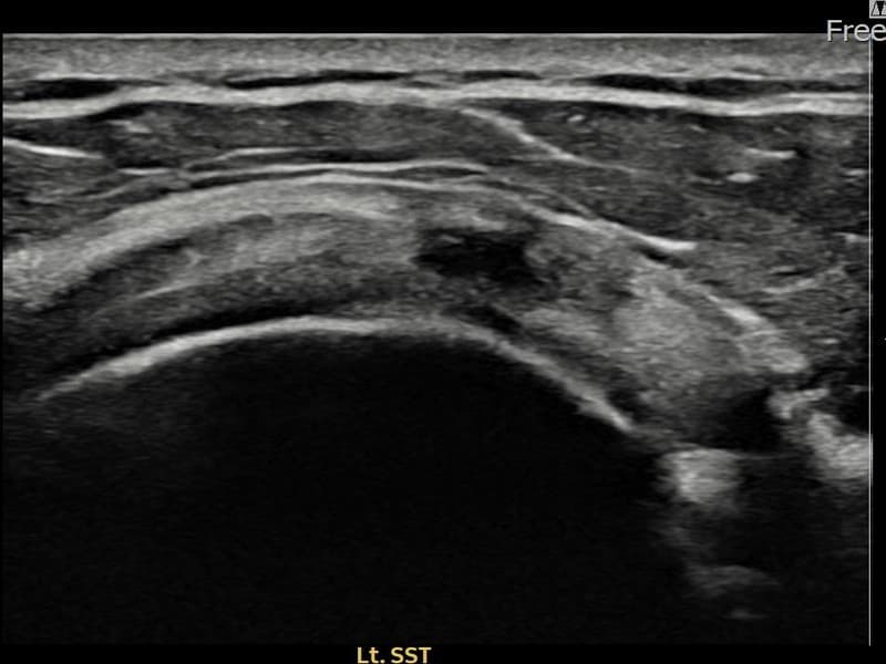 病例No.24 — 术前