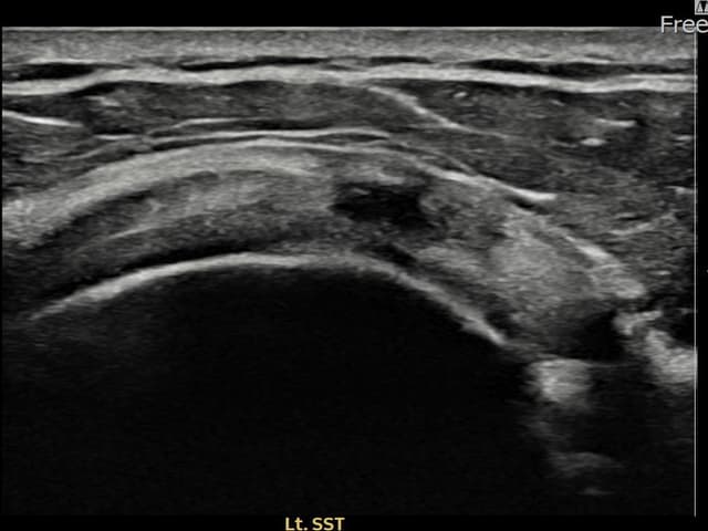 ケース 24 施術前