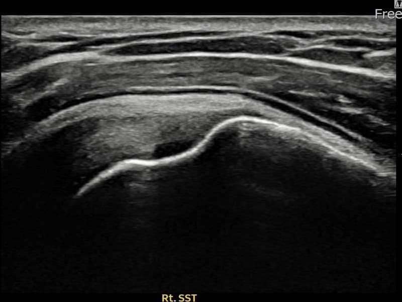 病例No.25 — 术后