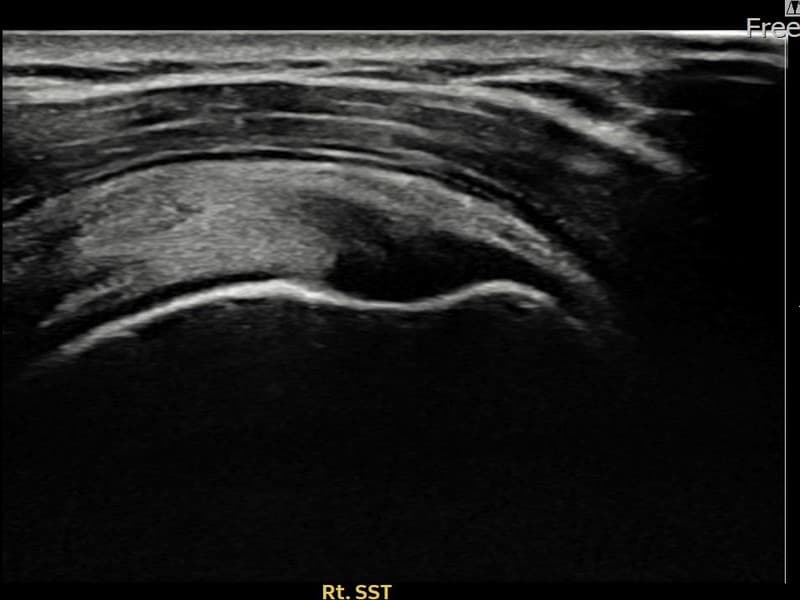 病例No.25 — 术前