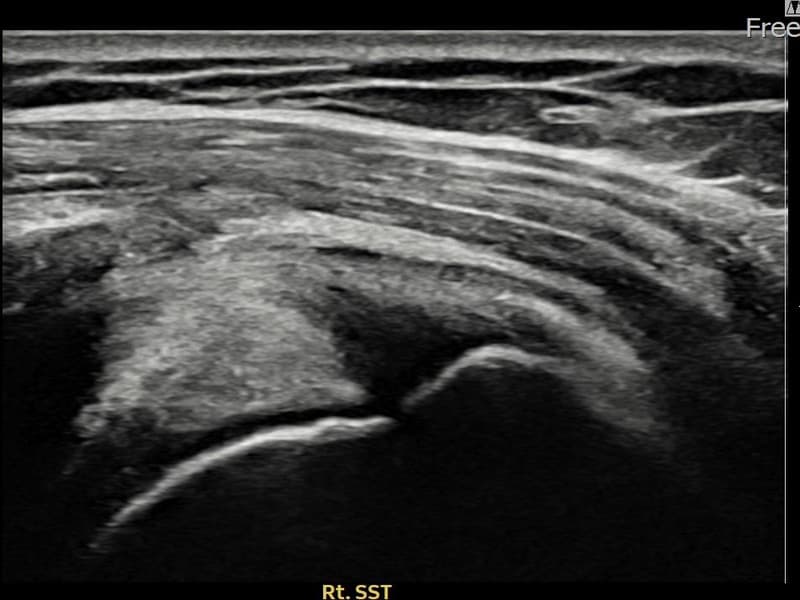 病例No.27 — 术前
