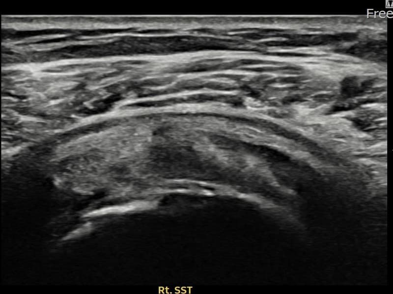 病例No.28 — 术后