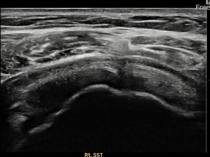 病例No.28 — 术前