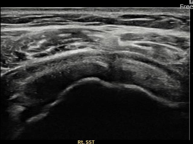 ケース 28 施術前