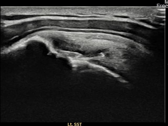 ケース 29 施術前