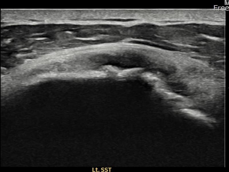 病例No.30 — 术前