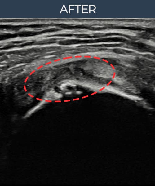 病例No.4 — 术后