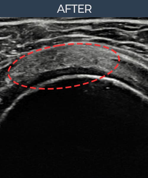 ケース 5 施術後