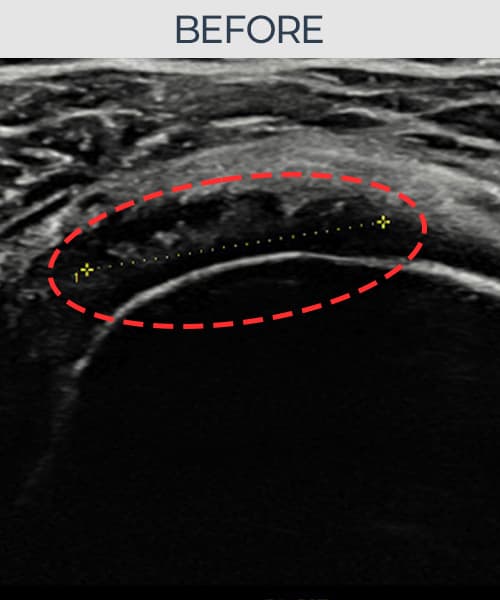 ケース 5 施術前