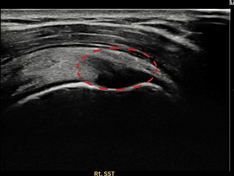 病例No.6 — 术前