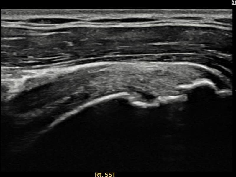 病例No.7 — 术后