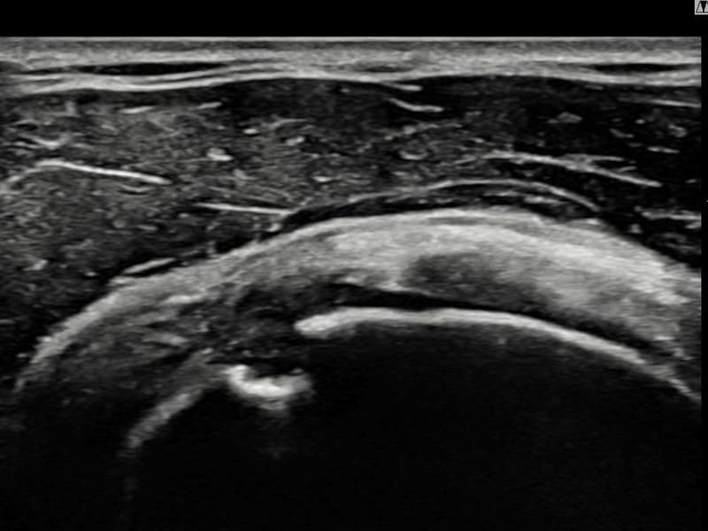 病例No.7 — 术前