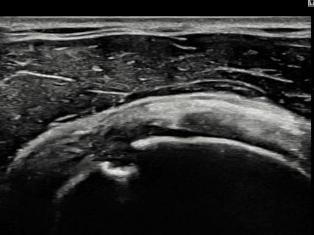 ケース 7 施術前