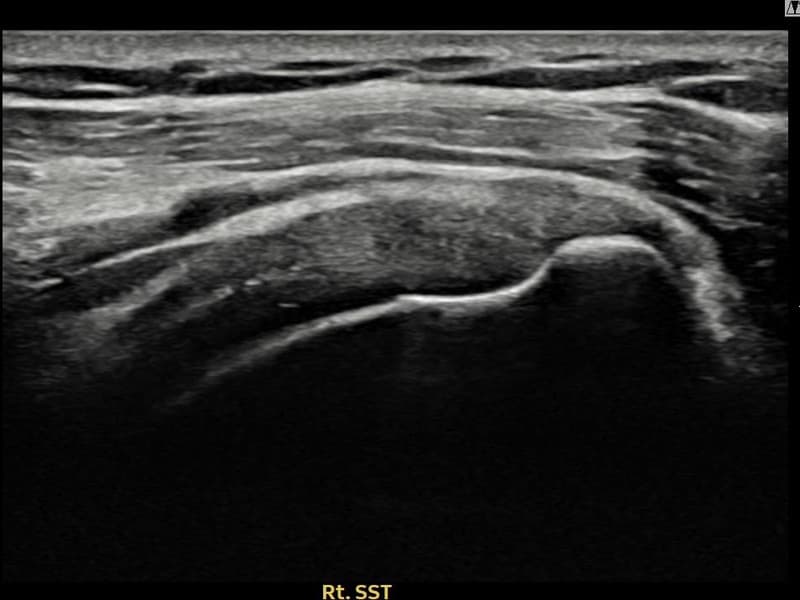 病例No.8 — 术后