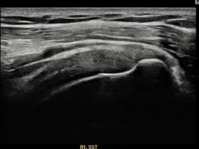 ケース 8 施術後