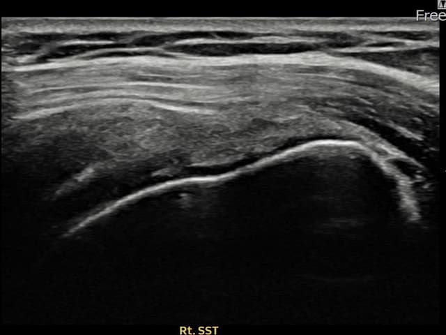 ケース 9 施術後