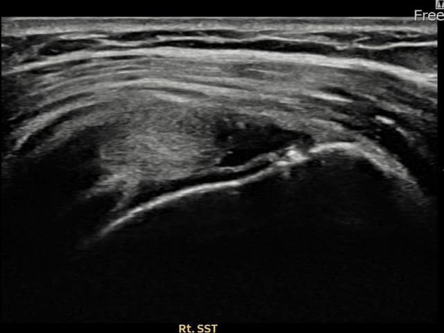 ケース 9 施術前
