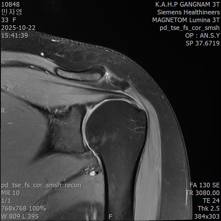 동일 환자의 MRI 영상 (정상 소견)