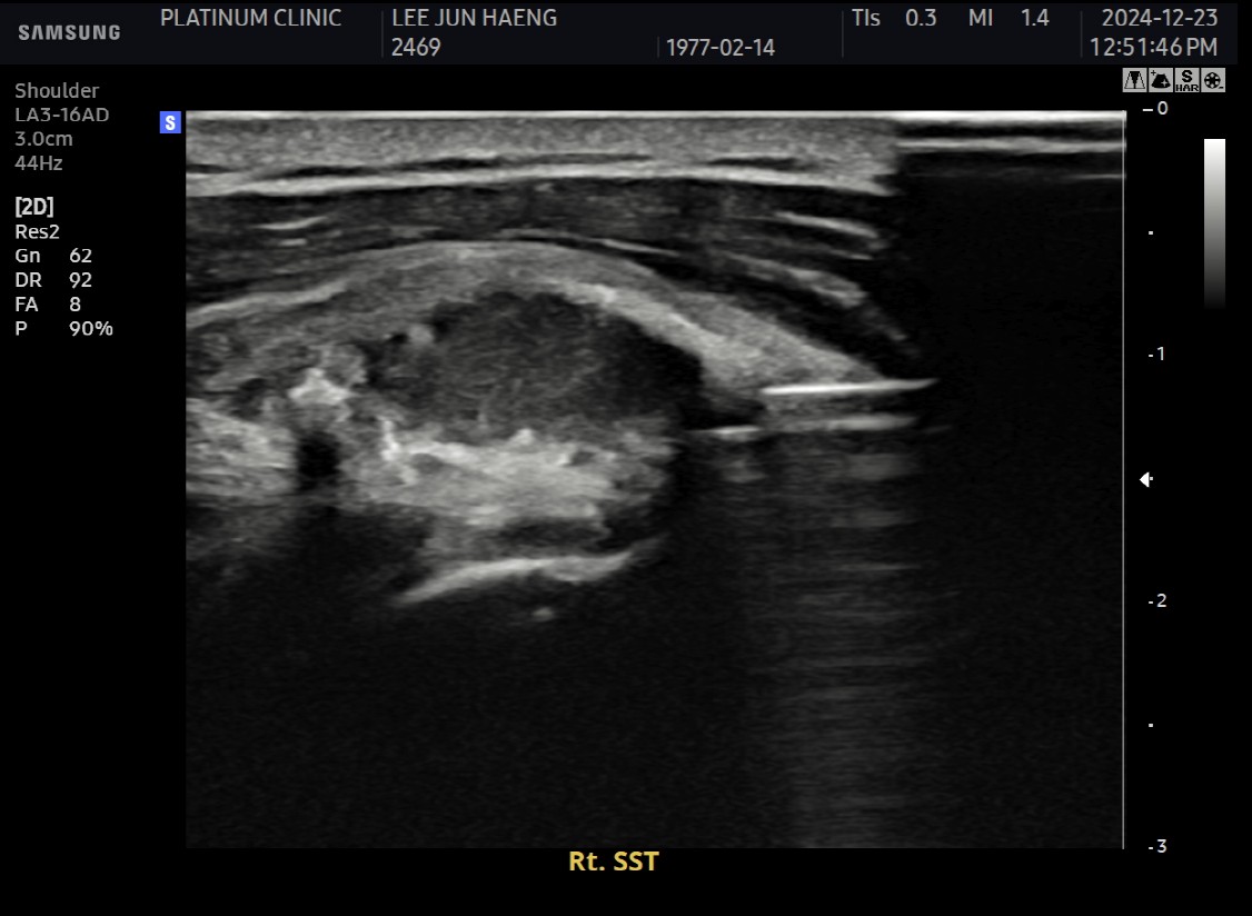 분쇄 전후 석회 상태 비교