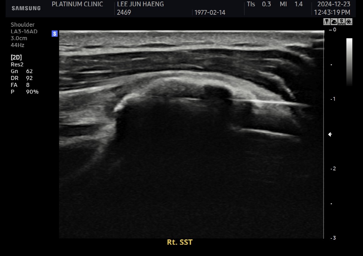 석회 분쇄 과정