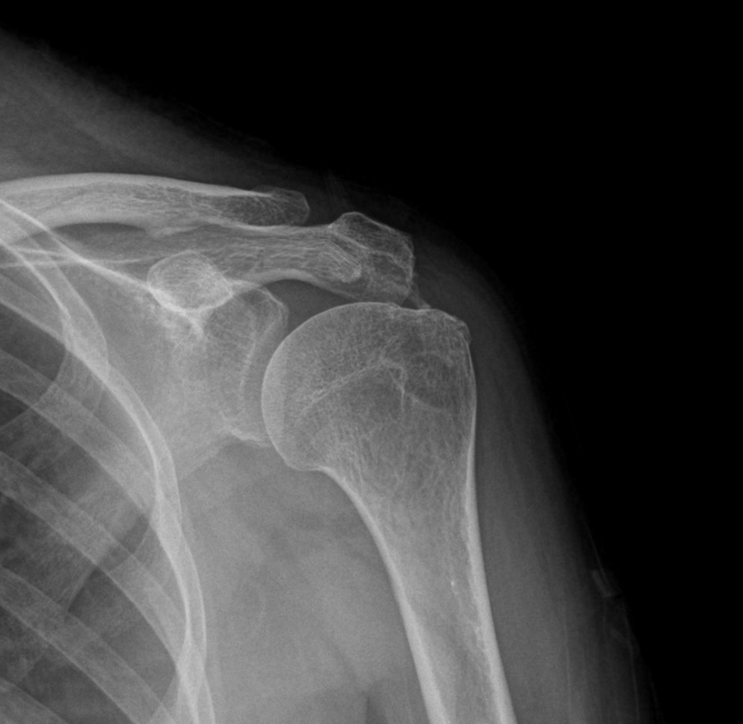 임산부 환자 시술 후 초음파