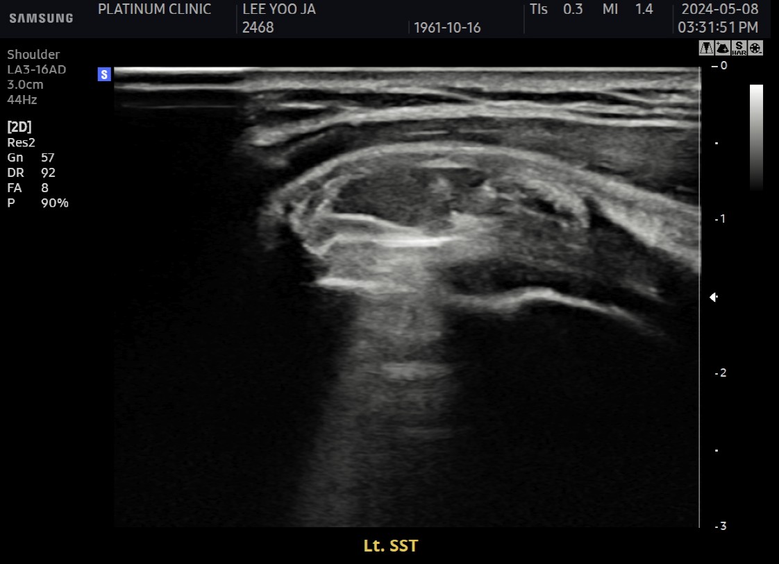 흡입 + 세척 시스템