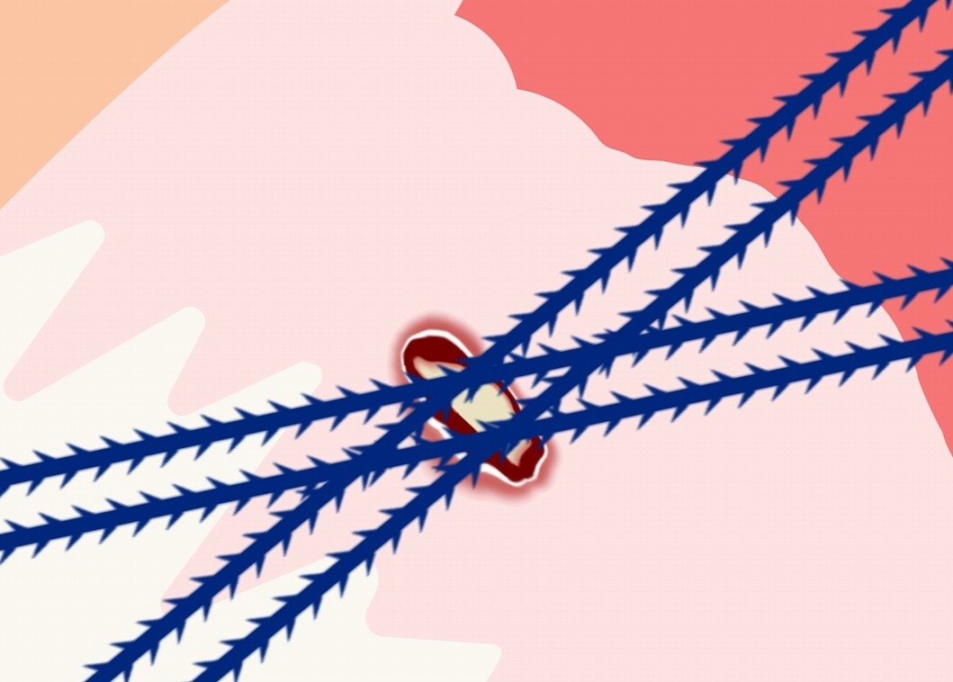 축소봉합술 개념