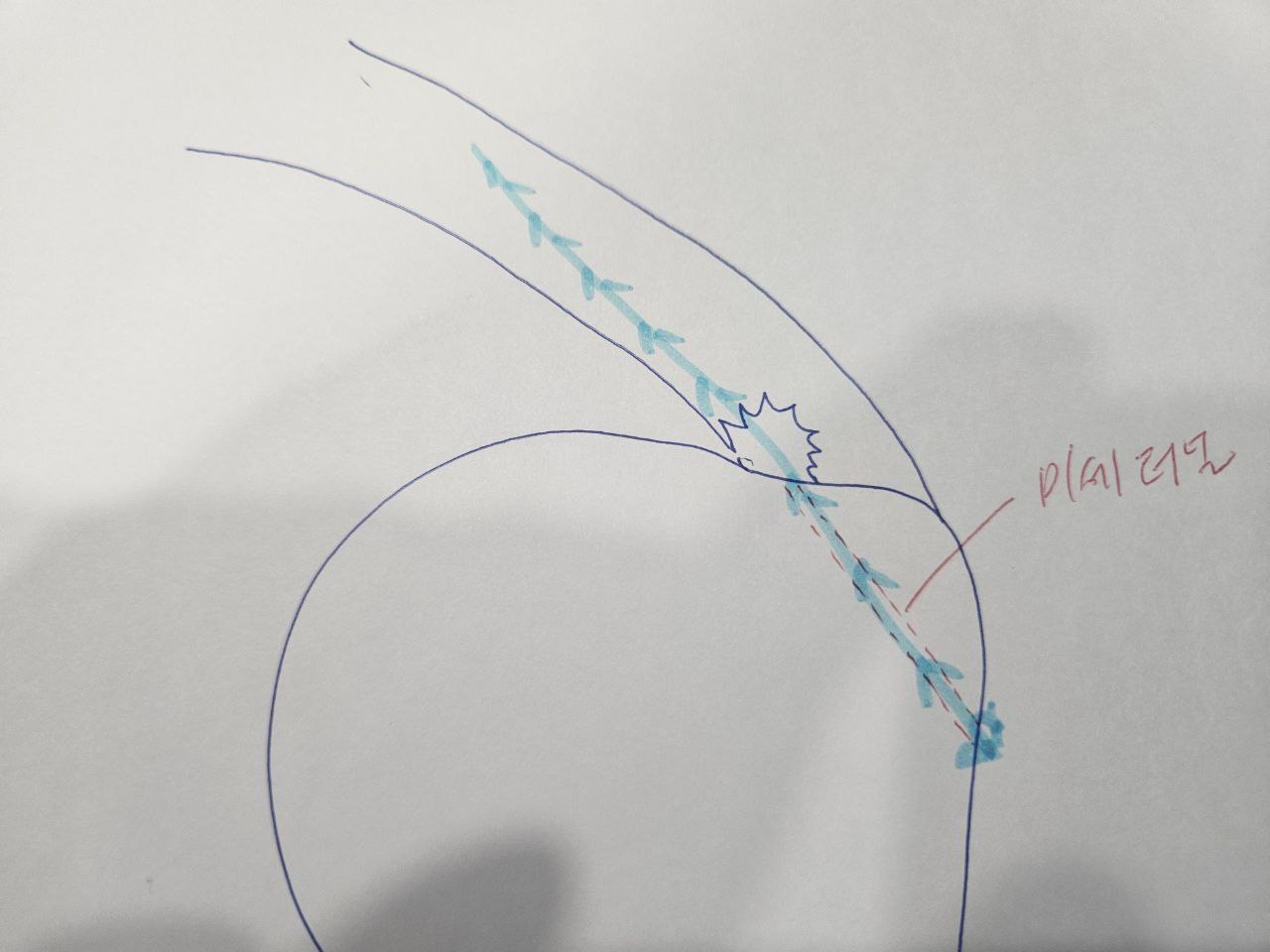 봉합사 삽입 및 인대 통과 1